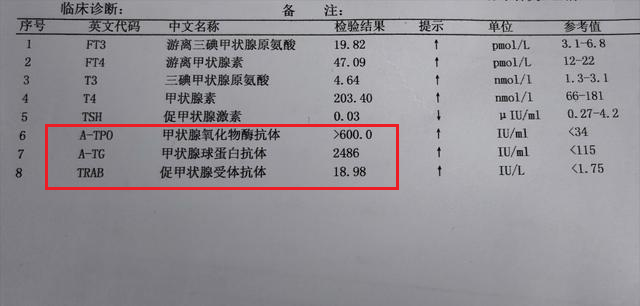 甲亢如何诊断怎么判断自己的甲亢严不严重