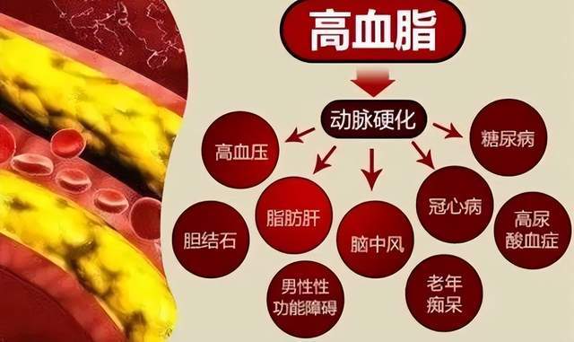 如果有高血脂不积极预防治疗又会怎样?