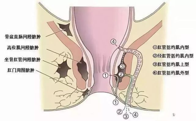 肛窦则是继