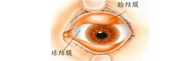 眼结膜分为睑结膜和球结膜,富含血管.1.