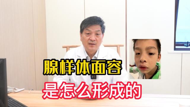 腺样体面容是怎么形成的?有办法预防吗?