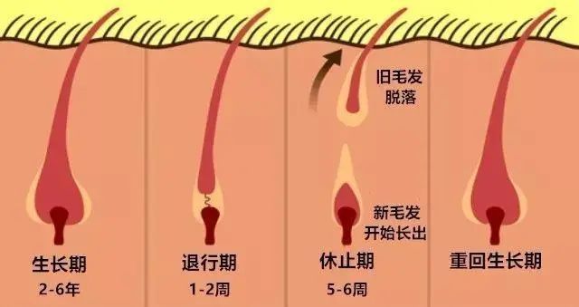 深圳肤康皮肤病专科头发掉的多可能是毛囊出了问题