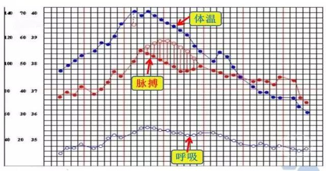 护理绘制体温,脉搏,呼吸要点总结