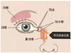 导致婴儿泪腺不通的原因:2,在按压宝宝泪囊区时,脓性分泌物会增加.