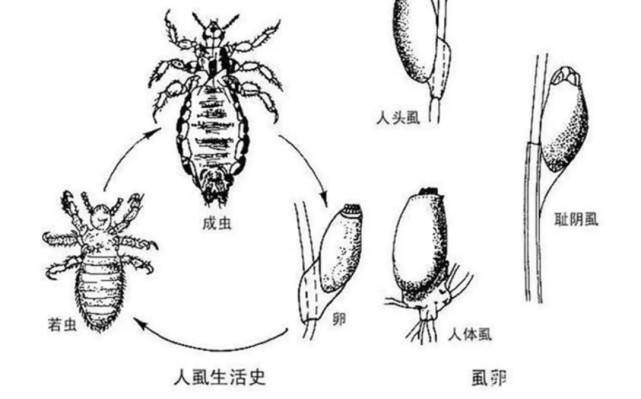 "虱子"是一种寄生虫,与我们共存千万年,为何这几年见不到了?