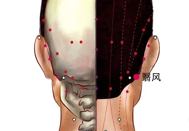 翳风穴提神偏头痛就翳风