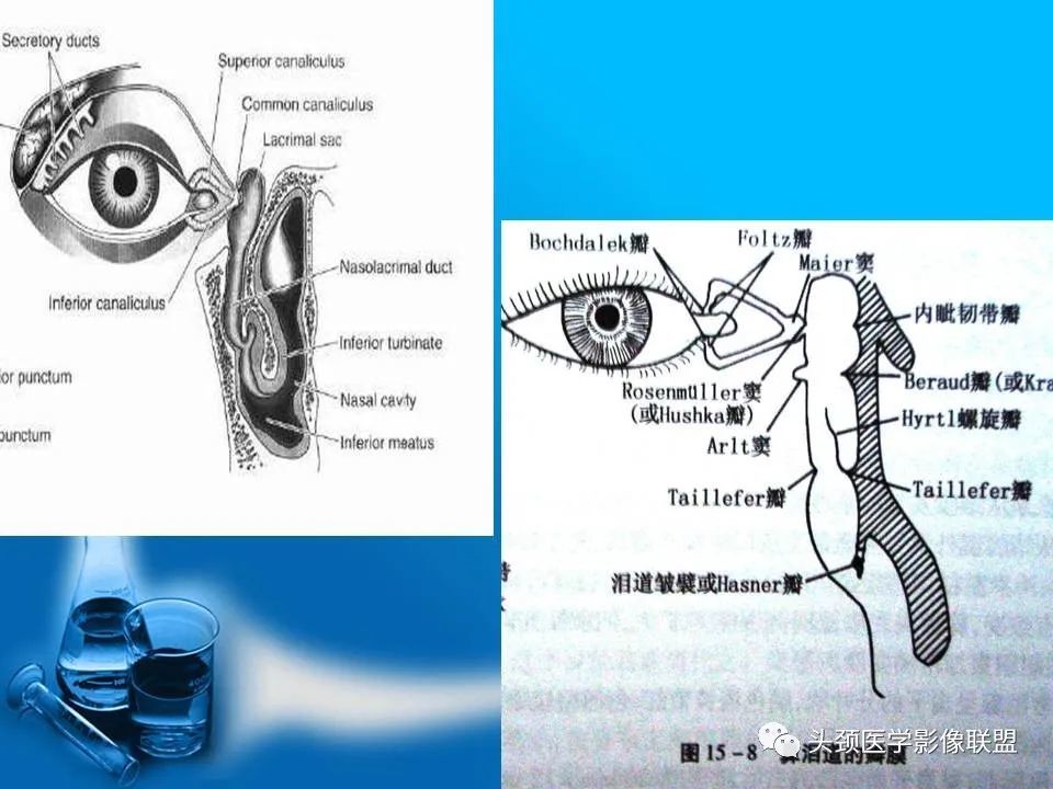 泪器影像解剖