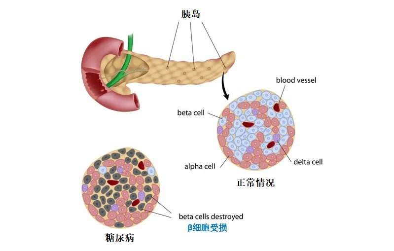 胰岛不好血糖如何能好这款维生素或能让你的胰岛重获新生