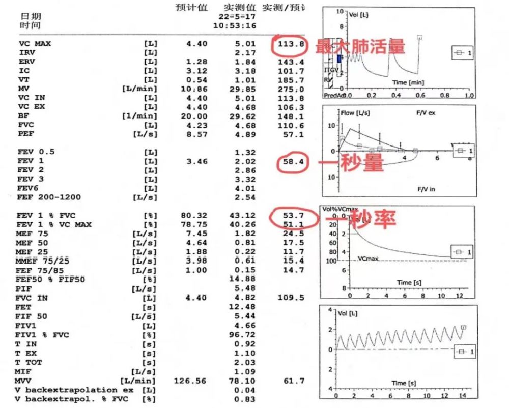 肺功能检查结果知多少哪些指标最重要