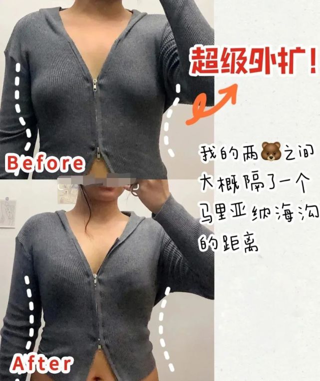 来个实拍的上身图给你们感受一下,这个妹子原本的胸型有轻微下垂,外扩