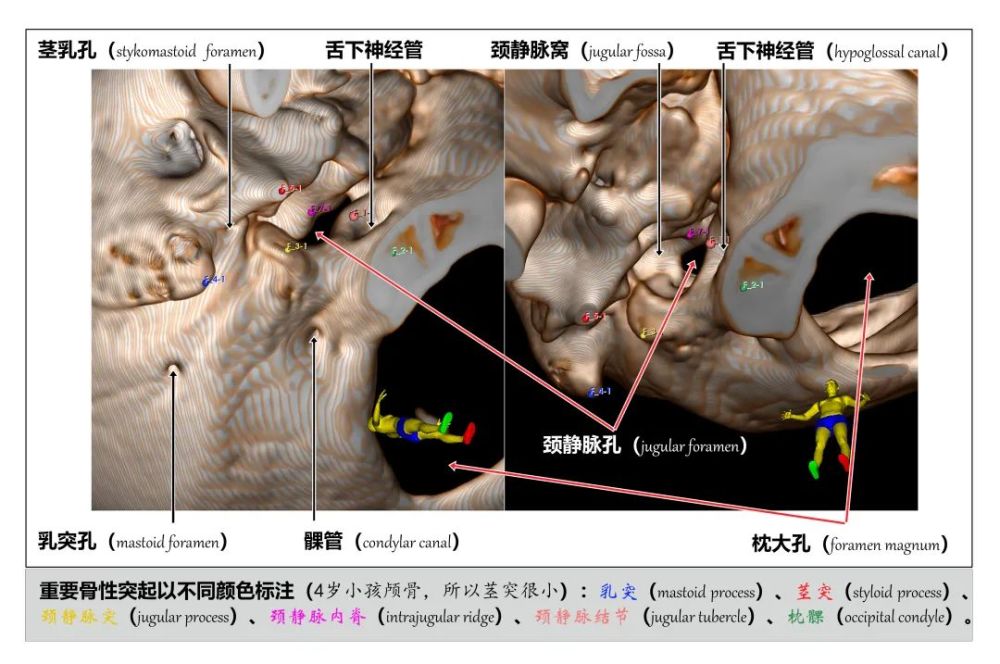 颈静脉孔周围骨性解剖结构