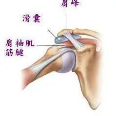 北京中针埋线医学研究院治疗肩峰下滑囊炎