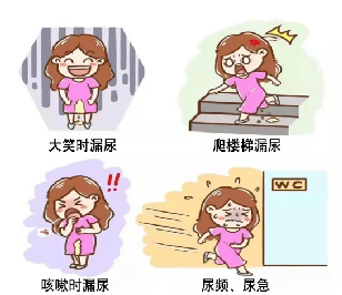 不可忽视的女性尿失禁上海指南