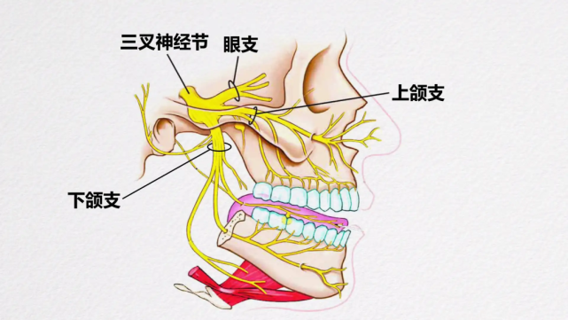 让人痛不欲生的三叉神经痛,只要一个小球囊就可以解决啦!