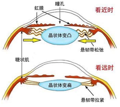 看下图很形象地解释了我们眼睛变焦的过程,镜头就是眼睛的屈光系统