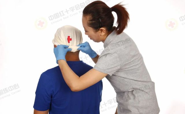 应急救护科普|三角巾包扎之头顶帽式包扎