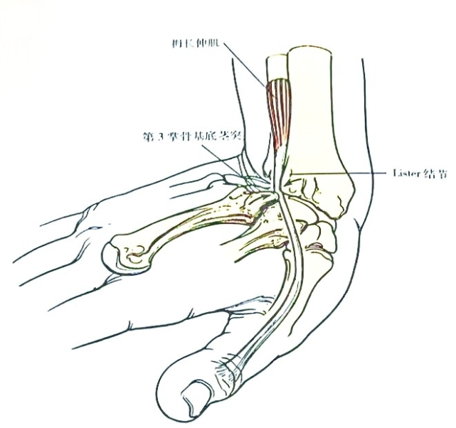 腕关节背侧入路的解剖应用和技巧详解