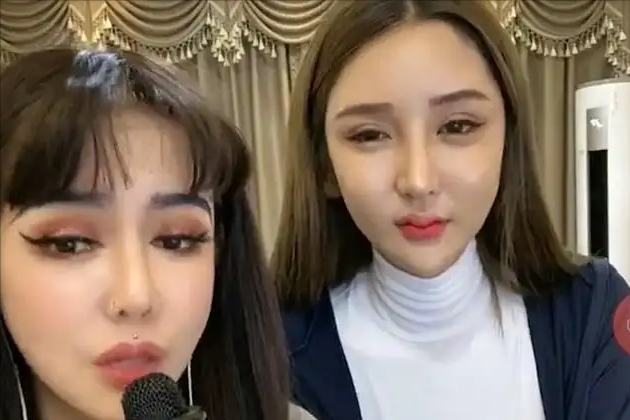 桃花宝宝整容8年,花费近百万,晒"美"照后遗症严重