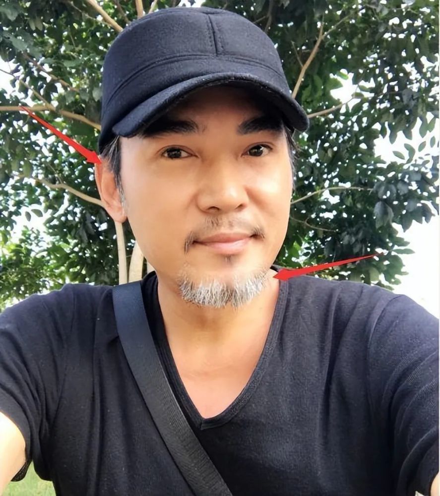 主要还是因为焦恩俊的皮肤紧致饱满,五官几乎和年轻时