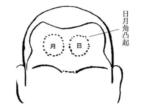 额头日月角突出面相