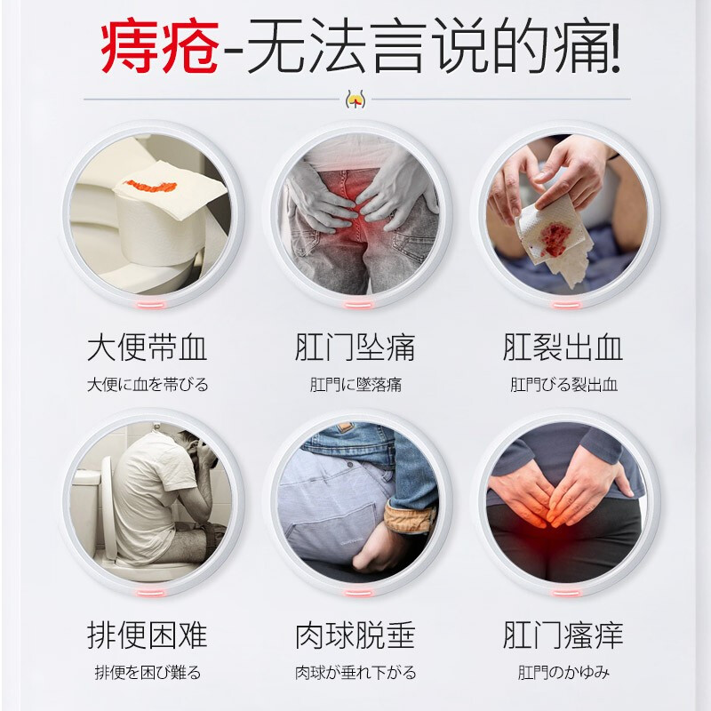 大便出血不要紧张只有满足这几个症状才是痔疮