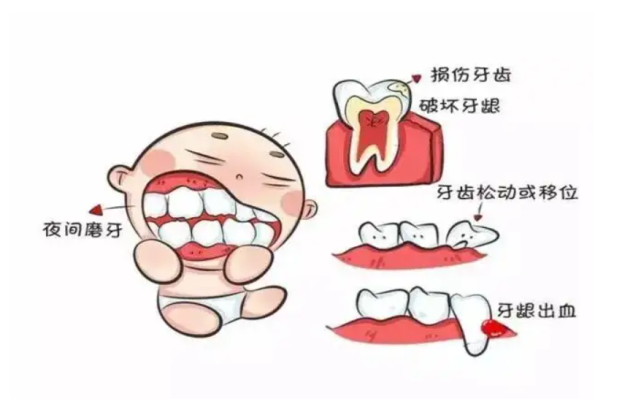 儿童牙病预防15大危害误区,家长必看!