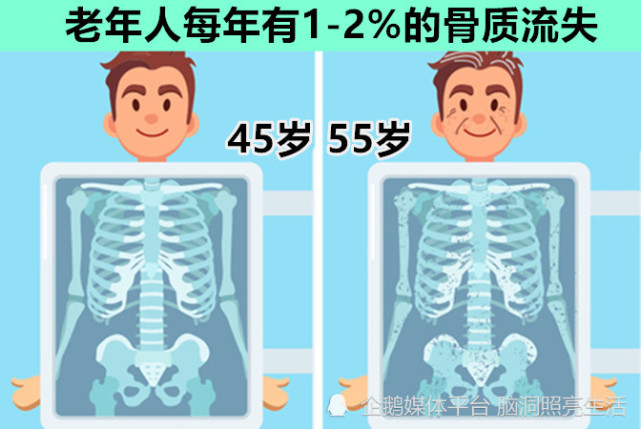 随着年龄的增长,我们也开始失去肌肉和骨骼质量,尤其是在50岁之后