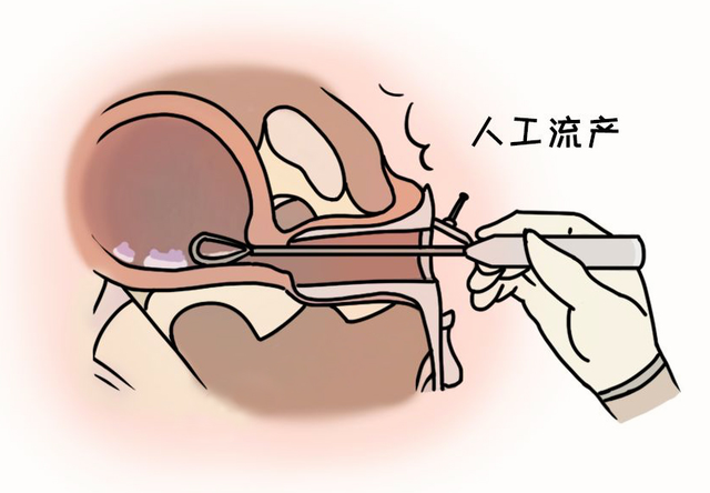 人流综合征 腾讯网