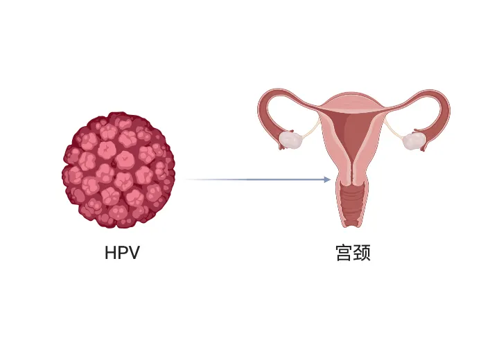 郑州合心医院女性朋友看这5点建议考虑做hpv检测