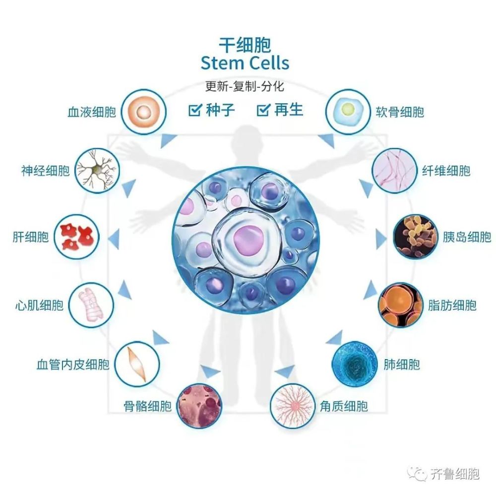 齐鲁健康干细胞从根源解除痛风之痛