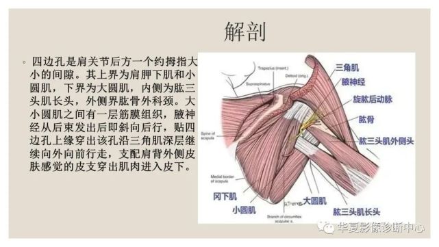 四边孔综合征的影像表现