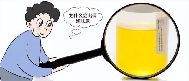 肾炎发病时身体出现6个表现,应及时治疗避免拖出尿毒症