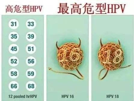 什么位置都要引起重视,特别是那种鸡冠状或者是菜花状的就更要注意了