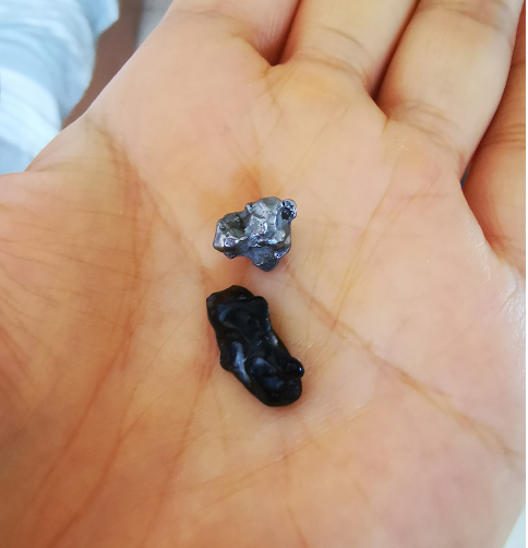 挖掘梦境深处的宝藏，梦见偶然在土里挖出很多金戒指的深层解读