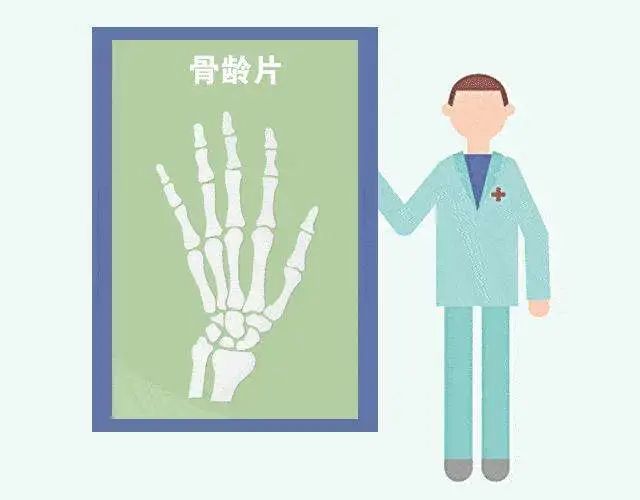 如何知道小孩的骨龄呢,需要借助于骨骼在x光摄像中的特定图像来确定.