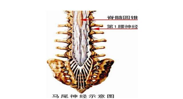 骶骨囊肿和马尾神经有什么关联吗?为何症状如此相似