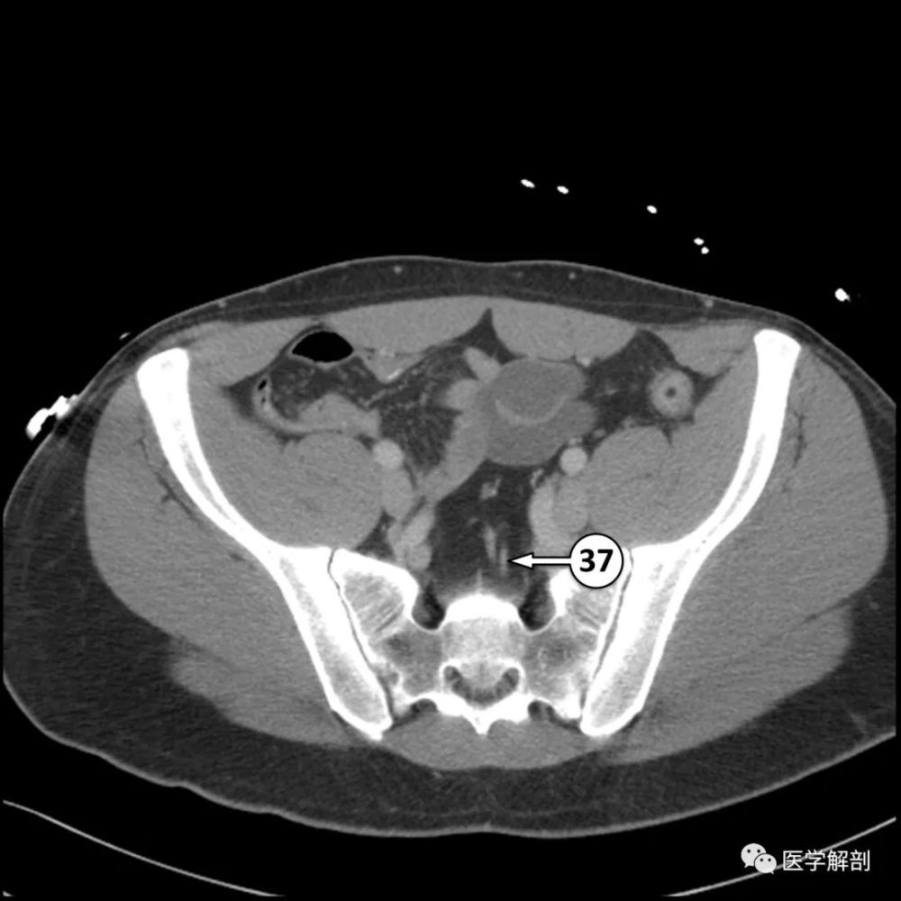 5分钟看完这篇学会全腹ct解剖