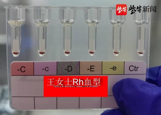 江苏发现2例全球罕见黄金血型（南京免费注册公司方法）