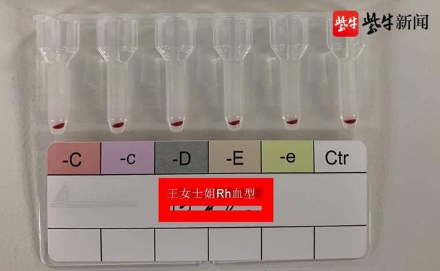 江苏发现2例全球罕见黄金血型（南京免费注册公司方法）