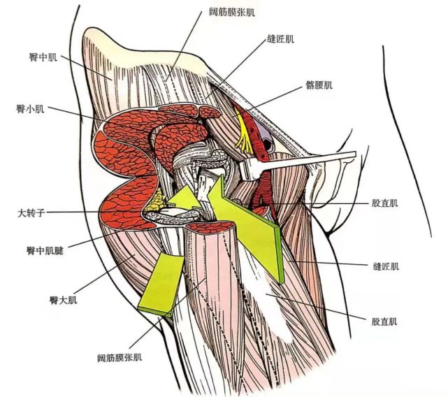 髋关节前侧入路和前外侧入路利用的平面都涉及阔筋膜张肌.