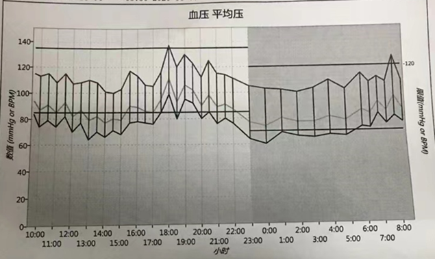 看到动态血压报告就头大?手把手教你识别各种参数