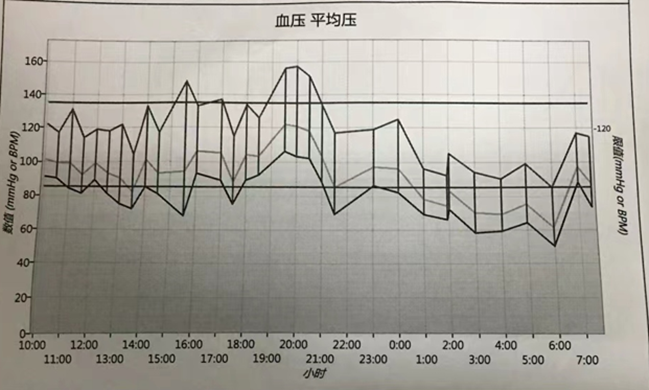 图4 超杓型血压(夜间血压下降≥20)图5 反杓型血压(夜间血压下降不足