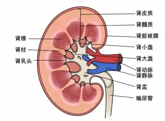 若肾盏角度不好,尤其是肾下盏与输尿管的夹角特别