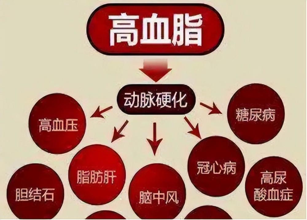 高脂血症若不及时服药,长此以往极易出现动脉粥样硬化,更甚者出现