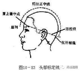 首先要掌握头部刺激区的定位首先要明确前后正中线和眉枕线的部位.