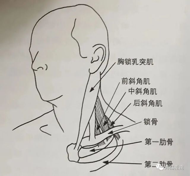 斜角肌,肱三头肌触发点疗法