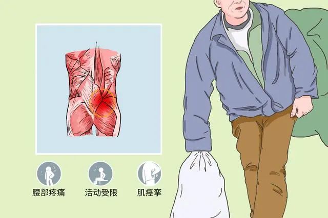 腰肌痉挛 腾讯网