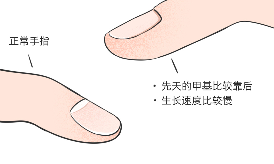 为什么有的人指甲上有月牙有的却没有科学解释来了