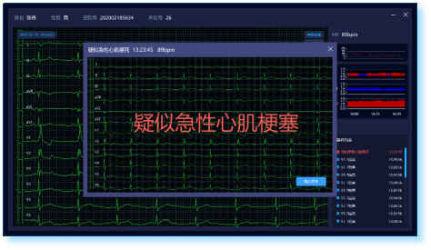 cardioai获批—人工智能赋能智慧胸痛·心电一张网