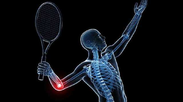 网球肘最佳治疗方法用什么药